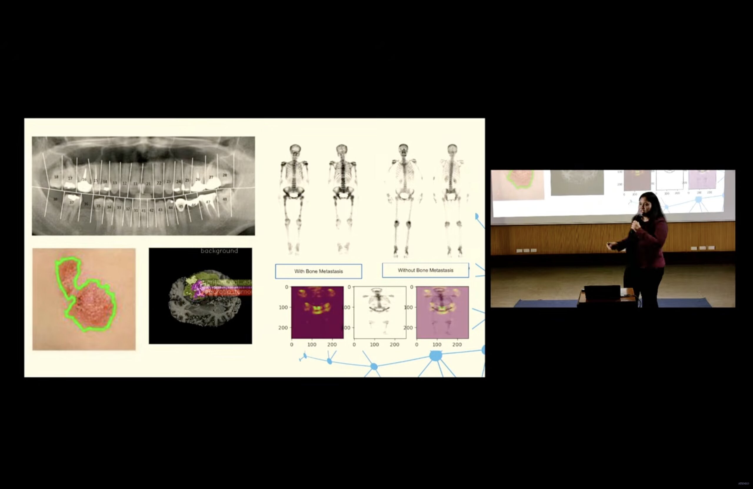 Dr Pai Abu demonstrates how doctors carefully teach a smart visual system to identify patterns and features on the human body that are of potential medical interest. Such interdisciplinary partnerships between topic experts and computer scientists are invaluable towards developing practical real-world solutions. SOURCE: OAVP-RCWI, 2026.